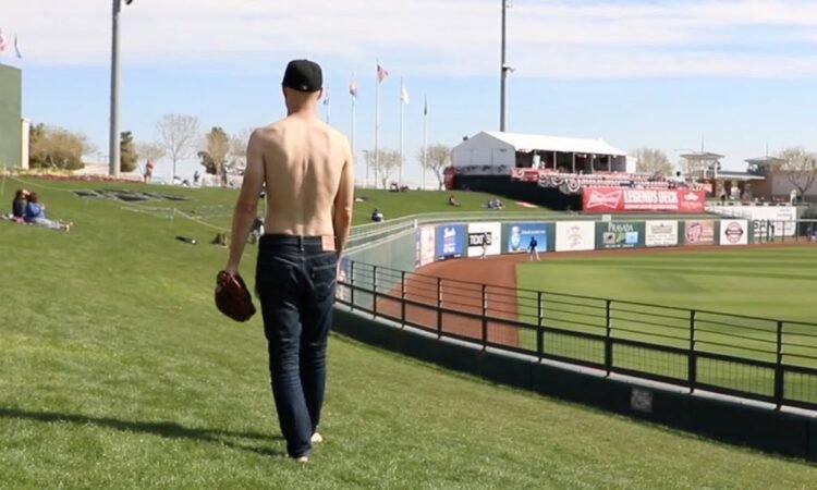 Farmers Tan: How to get Rid of a Farmers Tan