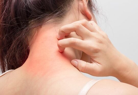 Does Jock Itch Really Go Away?