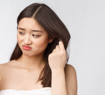 hair loss due to stress