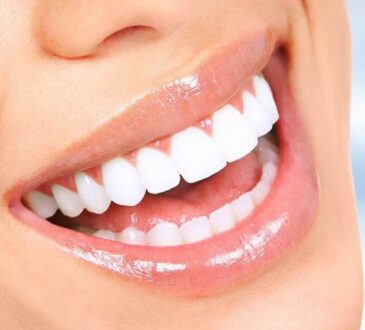 tooth replacement in Perth