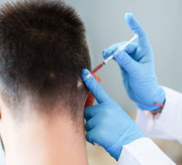 prp for male hair loss