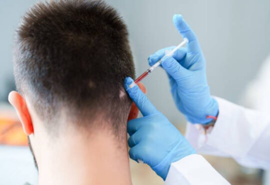 prp for male hair loss